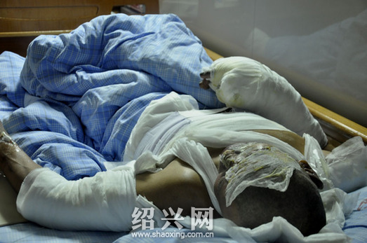 昨晚绍兴县龙洋纺织印染厂油管爆炸 55岁工人