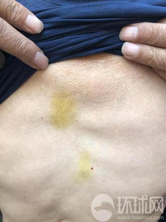 去瑞典中国游客:有失去理智的举动